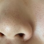 [댓글부탁해] 씹혐)나 블랙<b>헤드</b> 진짜 개 ㄹㅈㄷ다