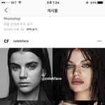 [19] 이분 입술<b>필러</b>맞은거 전후뭐가더이쁨?