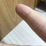 [댓글부탁해] 얘<b>도라</b> 이거 손가락에 뭐 난거임?ㅠㅠ