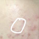 [이것좀봐줘] 나 <b>김</b>판녀 여드름 좋아<b>진</b> 썰 푼다 (조콤 혐주의)