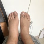 [방탈죄송] 한의원의 어이없는 대처에 화가 납니다. (사진징그러울수있어요...