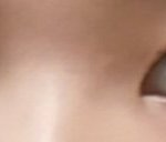 쌍수 추반 해주면 인서울함