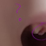 [제발도움좀] <b>잇몸</b>에 하얀거