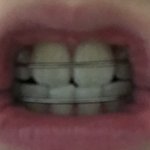 내 기준 <b>교정</b> 가장 _같은 화룡점정 ㄹㅇ