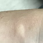 아 ㅅㅂ 모기련이 ㅈㄴ쳐<b>물음</b> 개빡치네