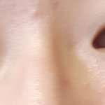 나중에 눈쪽에 수술하고시픈데...어디하는게 나을거같애?