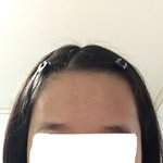 나 <b>이마</b> 조카 넓지
