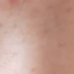 [19] 쌍수하고싶다 거울 볼 때마다 우울해