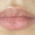 사진ㅇ) 내입술 ㅈㄴ 스트레스임 어떡함