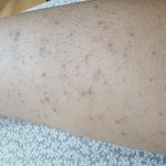  왁<b>싱</b> 후 일어난 일입니다. 한 번만 읽어주세요..제발 부탁드립니다...