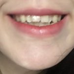 보조개 <b>판별</b>해줘