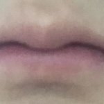 나 교정전후 입<b>모양</b> 변화 개심함