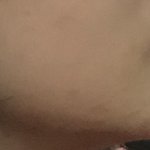 나 주걱턱 얼마나심하냐