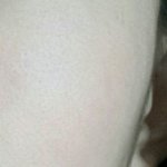 [댓글부탁해] 나같은 애는 무슨 성형해야돼????