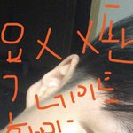 [성형고민] 남잔데 <b>속쌍</b> 만들어졌거든??? 쌍수할까