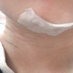 [이것좀봐줘] 아니 점빼봤으니까 질문좀 해달라<b>거어</b>
