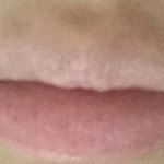 [이것좀봐줘] 입꼬리 비대칭 ㅅㅂㅈ된다 ㅈㄴ심해 실려줘