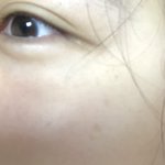 [댓글부탁해] 얘들아 나 쌍수랑 애굣살 <b>필러</b>좀 봐줘