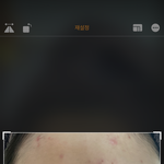 나 피부 __<b>창남</b> ㅠ 혐주의