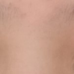 ㅆㅂ <b>야들</b>아 급해 내 쌍꺼풀 왜 이렇게됨ㅠㅠㅠ