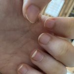 내<b>손톱</b> 개짜증나
