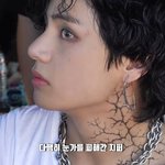눈 다친 방탄 <b>뷔</b> ㅜㅜ