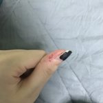 나 손뜯는 <b>버릇</b> 좀 심한데