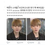 <b>변백현</b> 붓기