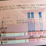 시약선 불량일까요?