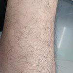 [댓글부탁해] (극혐주의) 나 다리털 진짜 ㅈㄴ많음