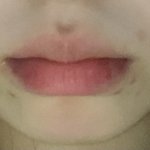 <b>입</b> <b>주변</b> 어짜노 ㅠㅠㅠㅠㅠㅠㅠㅠㅠㅠ