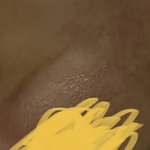[19] 아토피 있는 애들 들어와주라 ㅜ