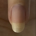 [댓글부탁해] 내 <b>손톱</b> 왜이러는지 아는사람 ㅅㅂ