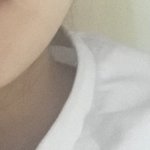 [19] 여자들은 목 길어지는 <b>시술</b> 받아라ㅋㅋ