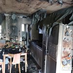 아파트서 불…10대 전신 화상