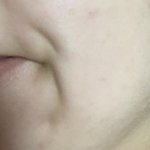 이것도 보조개임? <b>주름</b>인가?