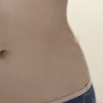 [댓글부탁해] 나만 <b>골반</b> 조카 비대칭임?