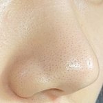 [댓글부탁해] 코 블랙헤드 피지 없애는 꿀팁 턴다 (전/후 사진주의)