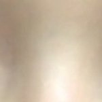 나 눈썹거상할까 쌍수할까