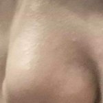 나 1년 반동안 코 개바뀜