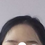 [댓글부탁해] <b>경락</b>으로 이만큼 작아질수 있을까?