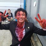 [19] <b>칼빵</b>맞았는데 그와중에 인증샷남기는 사람