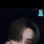 [드루와] 나 생리때도 아닌데 여드름이 <b>며칠사이</b>에 막 올라와