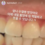 [<b>승헌</b>쓰] 깨끗해진 숭황숭 이빨