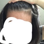 [NCT즌] ㅅㄷ) 야 나 탈모임? 아까 <b>탈모</b>쓰니인데
