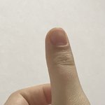 [이것좀봐줘] 엄지손톱이 <b>jonna</b>아파 tlqlf