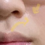 야 이거 <b>팔자</b>주름 맞지ㅅㅂ