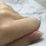 <b>손톱</b> 털 이거 왜이렂