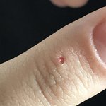 [19] 아 <b>tlqkf</b> 이거 언제난겨