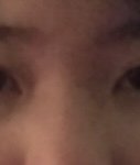 [사진] 콧구멍안에 플라스틱 코뽕 넣은나. <b>전후</b>